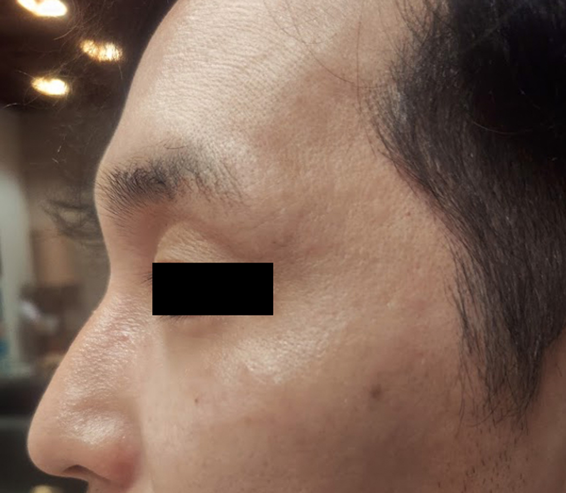 使用前：毛穴やクスミが目立つ40代男性の肌